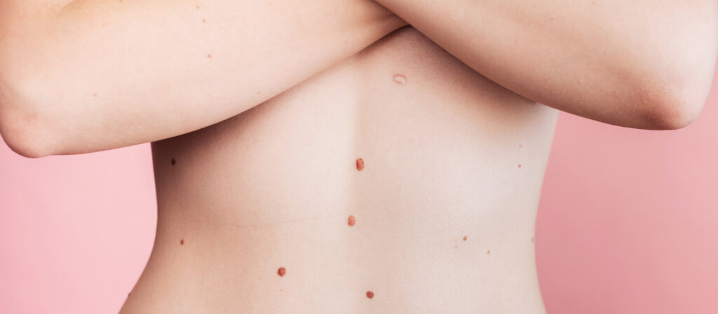 mappatura nei bielohub