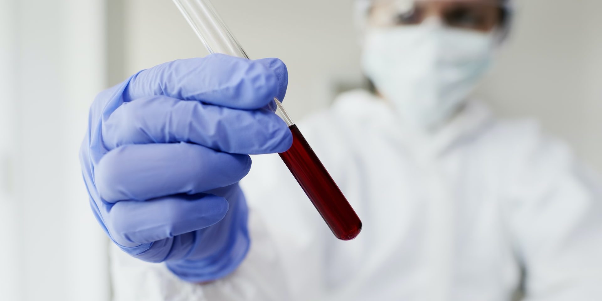 Test anticorpi COVID-19 per privati ed aziende