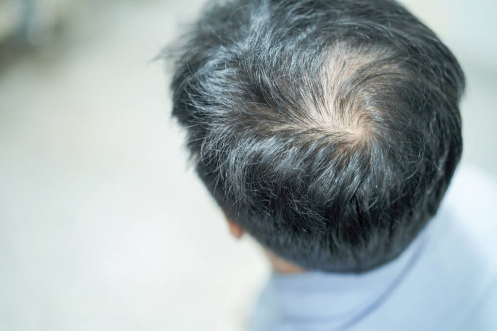 tricoscopia bielohub